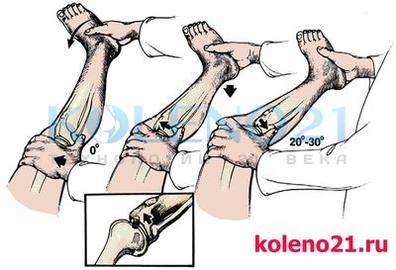 Тесты для коленного сустава thumbnail